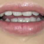 ＜痴女＞ 虫歯＆銀歯観光！！顔舐め咀嚼ツアー 瀬戸友里亜 【高画質】